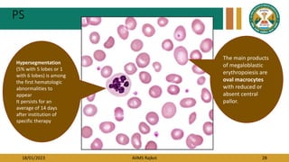 18/01/2023 AIIMS Rajkot 28
PS
The main products
of megaloblastic
erythropoiesis are
oval macrocytes
with reduced or
absent central
pallor.
Hypersegmentation
(5% with 5 lobes or 1
with 6 lobes) is among
the first hematologic
abnormalities to
appear
It persists for an
average of 14 days
after institution of
specific therapy
 