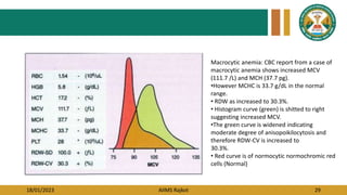 18/01/2023 AIIMS Rajkot 29
Macrocytic anemia: CBC report from a case of
macrocytic anemia shows increased MCV
(111.7 /L) and MCH (37.7 pg).
•However MCHC is 33.7 g/dL in the normal
range.
• RDW as increased to 30.3%.
• Histogram curve (green) is shitted to right
suggesting increased MCV.
•The green curve is widened indicating
moderate degree of anisopoikilocytosis and
therefore RDW-CV is increased to
30.3%.
• Red curve is of normocytic normochromic red
cells (Normal}
 