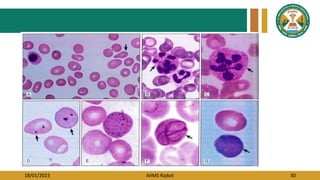 18/01/2023 AIIMS Rajkot 30
 