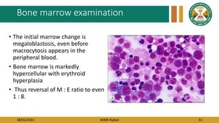 18/01/2023 AIIMS Rajkot 31
Bone marrow examination
• The initial marrow change is
megaloblastosis, even before
macrocytosis appears in the
peripheral blood.
• Bone marrow is markedly
hypercellular with erythroid
hyperplasia
• Thus reversal of M : E ratio to even
1 : 8.
 