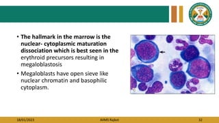 18/01/2023 AIIMS Rajkot 32
• The hallmark in the marrow is the
nuclear- cytoplasmic maturation
dissociation which is best seen in the
erythroid precursors resulting in
megaloblastosis
• Megaloblasts have open sieve like
nuclear chromatin and basophilic
cytoplasm.
 
