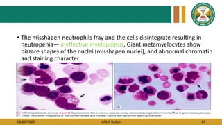 18/01/2023 AIIMS Rajkot 37
• The misshapen neutrophils fray and the cells disintegrate resulting in
neutropenia— ineffective myelopoiesis, Giant metamyelocytes show
bizzare shapes of the nuclei (misshapen nuclei), and abnormal chromatin
and staining character
 