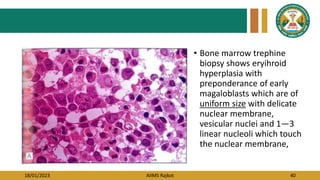 18/01/2023 AIIMS Rajkot 40
• Bone marrow trephine
biopsy shows eryihroid
hyperplasia with
preponderance of early
magaloblasts which are of
uniform size with delicate
nuclear membrane,
vesicular nuclei and 1—3
linear nucleoli which touch
the nuclear membrane,
 