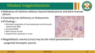 18/01/2023 AIIMS Rajkot 59
Masked megaloblastosis
Deficiency of vitamins without classical blood picture and bone marrow
picture.
Coexisting Iron deficiency or thalassemia
PS findings :
Dimorphic population of macroovalocytes and microcytic
hypochromic RBCs
Increased RDW
MCV may be normal
Hypochromic ovalocytes is a clue
Megaloblastic anemia (crisis) may be the initial presentation in
congenital hemolytic anemia
 