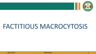 18/01/2023 AIIMS Rajkot 6
FACTITIOUS MACROCYTOSIS
 