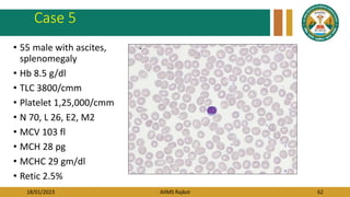 18/01/2023 AIIMS Rajkot 62
Case 5
• 55 male with ascites,
splenomegaly
• Hb 8.5 g/dl
• TLC 3800/cmm
• Platelet 1,25,000/cmm
• N 70, L 26, E2, M2
• MCV 103 fl
• MCH 28 pg
• MCHC 29 gm/dl
• Retic 2.5%
 