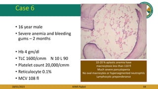 18/01/2023 AIIMS Rajkot 64
Case 6
• 16 year male
• Severe anemia and bleeding
gums – 2 months
• Hb 4 gm/dl
• TLC 1600/cmm N 10 L 90
• Platelet count 20,000/cmm
• Reticulocyte 0.1%
• MCV 108 fl
10-20 % aplastic anemia have
macrocytosis less than 110 fl
Much severe pancytopenia
No oval macrocytes or hypersegmented neutrophils
Lymphocytic preponderance
 