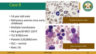 18/01/2023 AIIMS Rajkot 66
Case 8
• 14 year old male
• Refractory anemia since early
childhood
• Multiple transfusions
• Hb 6 gm/dl MCV 110 fl
• TLC 8700/cmm
• Platelet 3,50,000/cmm
• DLC – normal
• Retic 1%
Peripheral blood in CDA-I
Bone marrow in CDA-I
 
