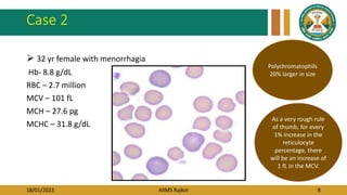 18/01/2023 AIIMS Rajkot 8
Case 2
 32 yr female with menorrhagia
Hb- 8.8 g/dL
RBC – 2.7 million
MCV – 101 fL
MCH – 27.6 pg
MCHC – 31.8 g/dL
Polychromatophils
20% larger in size
As a very rough rule
of thumb, for every
1% increase in the
reticulocyte
percentage, there
will be an increase of
1 fL in the MCV.
 
