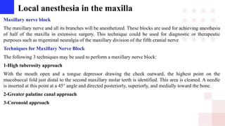 Local anesthesia in the maxilla
Maxillary nerve block
The maxillary nerve and all its branches will be anesthetized. These blocks are used for achieving anesthesia
of half of the maxilla in extensive surgery. This technique could be used for diagnostic or therapeutic
purposes such as trigeminal neuralgia of the maxillary division of the fifth cranial nerve
Techniques for Maxillary Nerve Block
The following 3 techniques may be used to perform a maxillary nerve block:
1-High tuberosity approach
With the mouth open and a tongue depressor drawing the cheek outward, the highest point on the
mucobuccal fold just distal to the second maxillary molar teeth is identified. This area is cleaned. A needle
is inserted at this point at a 45° angle and directed posteriorly, superiorly, and medially toward the bone.
2-Greater palatine canal approach
3-Coronoid approach
 