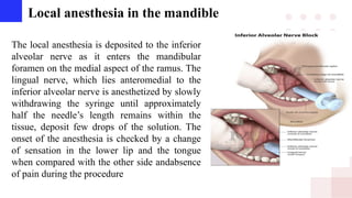Local anesthesia in the mandible
The local anesthesia is deposited to the inferior
alveolar nerve as it enters the mandibular
foramen on the medial aspect of the ramus. The
lingual nerve, which lies anteromedial to the
inferior alveolar nerve is anesthetized by slowly
withdrawing the syringe until approximately
half the needle’s length remains within the
tissue, deposit few drops of the solution. The
onset of the anesthesia is checked by a change
of sensation in the lower lip and the tongue
when compared with the other side andabsence
of pain during the procedure
 