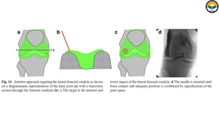 Toe Arthrogram 5_6208450663173593512 (1) arthrography.pptx