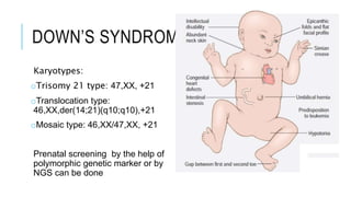 DOWN’S SYNDROME
Karyotypes:
oTrisomy 21 type: 47,XX, +21
oTranslocation type:
46,XX,der(14;21)(q10;q10),+21
oMosaic type: 46,XX/47,XX, +21
Prenatal screening by the help of
polymorphic genetic marker or by
NGS can be done
 