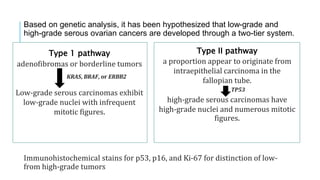Based on genetic analysis, it has been hypothesized that low-grade and
high-grade serous ovarian cancers are developed through a two-tier system.
Immunohistochemical stains for p53, p16, and Ki-67 for distinction of low-
from high-grade tumors
Type II pathway
a proportion appear to originate from
intraepithelial carcinoma in the
fallopian tube.
high-grade serous carcinomas have
high-grade nuclei and numerous mitotic
figures.
Type 1 pathway
adenofibromas or borderline tumors
Low-grade serous carcinomas exhibit
low-grade nuclei with infrequent
mitotic figures.
KRAS, BRAF, or ERBB2
TP53
 