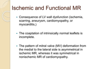 Ischemic and Functional MR
 Consequence of LV wall dysfunction (ischemia,
scarring, aneurysm, cardiomyopathy, or
myocarditis,)
 The coaptation of intrinsically normal leaflets is
incomplete.
 The pattern of mitral valve (MV) deformation from
the medial to the lateral side is asymmetrical in
ischemic MR, whereas it was symmetrical in
nonischemic MR of cardiomyopathy.
 