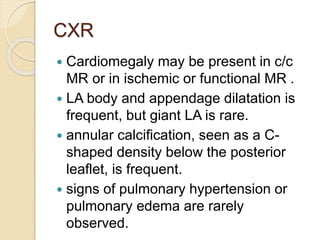 CXR
 Cardiomegaly may be present in c/c
MR or in ischemic or functional MR .
 LA body and appendage dilatation is
frequent, but giant LA is rare.
 annular calcification, seen as a C-
shaped density below the posterior
leaflet, is frequent.
 signs of pulmonary hypertension or
pulmonary edema are rarely
observed.
 