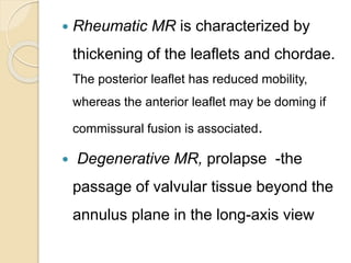  Rheumatic MR is characterized by
thickening of the leaflets and chordae.
The posterior leaflet has reduced mobility,
whereas the anterior leaflet may be doming if
commissural fusion is associated.
 Degenerative MR, prolapse -the
passage of valvular tissue beyond the
annulus plane in the long-axis view
 