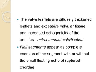  The valve leaflets are diffusely thickened
leaflets and excessive valvular tissue
and increased echogenicity of the
annulus - mitral annular calcification.
 Flail segments appear as complete
eversion of the segment with or without
the small floating echo of ruptured
chordae
 