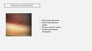 Gonioscopy...........................pptx