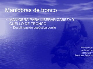Maniobras de tronco
• MANIOBRA PARA LIBERAR CABEZA Y
CUELLO DE TRONCO
o Desalineación espástica cuello
Protracción
anterior de
escápula y
Rotación Externa
 