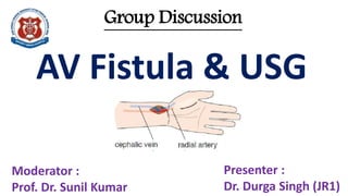 Group Discussion
Presenter :
Dr. Durga Singh (JR1)
Moderator :
Prof. Dr. Sunil Kumar
AV Fistula & USG
 