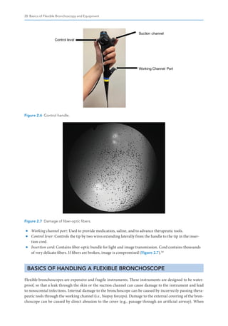 Pediatric Bronchoscopy for Clinicians Kara D. Meister | PDF