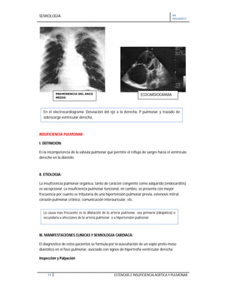 SEMIOLOGIA VII
CICLO2011
11 ESTENOSIS E INSUFICIENCIA AORTICA Y PULMONAR
INSUFICIENCIA PULMONAR
I. DEFINICION:
Es la incompetencia de la válvula pulmonar que permite el reflujo de sangre hacia el ventrículo
derecho en la diástole.
II. ETIOLOGIA:
La insuficiencia pulmonar orgánica, tanto de carácter congénito como adquirido (endocarditis)
es excepcional. La insuficiencia pulmonar funcional, en cambio, se presenta con mayor
frecuencia por cuanto es tributaria de una hipertensión pulmonar previa, estenosis mitral,
corazón pulmonar crónico, comunicación interauricular, etc.
III. MANIFESTACIONES CLINICAS Y SEMIOLOGIA CARDIACA:
El diagnostico de estos pacientes se formula por la auscultación de un soplo proto-meso
diastólico en el foco pulmonar, asociado con signos de hipertrofia ventricular derecha.
Inspección y Palpación
En el electrocardiograma. Desviación del eje a la derecha, P pulmonar y trazado de
sobrecarga ventricular derecha.
La causa mas frecuente es la dilatación de la arteria pulmonar, sea primaria (idiopática) o
secundaria a afecciones de la arteria pulmonar o a hipertensión pulmonar
PROMINENCIA DEL ARCO
MEDIO
ECOCARDIOGRAMA
 