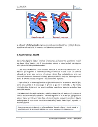 SEMIOLOGIA VII
CICLO2011
9 ESTENOSIS E INSUFICIENCIA AORTICA Y PULMONAR
La estenosis valvular funcional siempre es consecutiva a una dilatación del ventrículo derecho
y o de la arteria pulmonar en pacientes con hipertensión pulmonar.
III. MANIFESTACIONES CLINICAS:
La estenosis ligera no produce síntomas. Si la estenosis es más severa, los síntomas pueden
ser disnea, fatiga, cianosis e ICC. A veces en casos severos, se puede producir tras esfuerzo
dolor precordial, sincope e incluso muerte.
La repercusión hemodinámica de la estenosis pulmonar se vincula en primer termino, con la
dificultad que se plantea al ventrículo derecho para impulsar en cada sístole una cantidad
adecuada de sangre para mantener el volumen minuto. Esta perturbación es tanto mas
ostensible cuanto mas severa es la estenosis, y en estos casos los enfermos pueden presentar
disnea de esfuerzo, estados sincopales, e incluso episodios anginosos.
La repercusión de la estenosis pulmonar se ejerce también sobre el ventrículo derecho que,
como consecuencia de la sobrecarga de presión a que se ve sometido, se hipertrofia,
exteriorizándose clínicamente por un vigoroso latido paraesternal izquierdo, a nivel del área
ventricular derecha.
El encadenamiento fisiológico determina también la hipertrofia de la auricular derecha, que se
contrae enérgicamente para contribuir a aumentar la presión de fin de diástole, y proporcionar
así más vigor a la sístole ventricular. Esta potente contracción auricular repercute en el pulso
venoso yugular de las estenosis pulmonares moderadas y graves, dando lugar a la producción
de ondas gigantes.
Los síntomas aparecen tardíamente en la forma adquirida; disnea de esfuerzo y cianosis cuando se
acusa la deficiencia de la hematosis pulmonar o es intensa la insuficiencia cardiaca derecha.
 