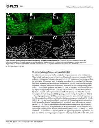 Hypomethylation of genes upregulated in BA
Several expression microarray studies have looked for genes important in BA pathogenesis.
These include studies performed on livers from BA patient livers, on mice injected with RRV,
and on in vitro models of biliary development [5, 6, 24, 25]. We examined our microarray data
for methylation differences in genes identified as upregulated in these studies. Several upregu-
lated genes were associated with decreased methylation in BA, with some genes having higher
magnitude changes in methylation, or decreased methylation in multiple neighboring probe-
sets (S3 Table). Notably, probesets near the KRT7, SMAD3, and LFNG loci demonstrated vary-
ing degrees of hypomethylation. KRT7 encodes for cytokeratin-7, a marker of newly formed
bile ducts [26],while LFNG expression modulates Notch signaling and SMAD3 is a known
transcription factor that regulates TGFβ signaling, which is an important pathway in BA [27].
Several groups have used the RRV mouse model to uncover genes potentially important in
BA. These studies have yielded several families of inflammatory genes, including IFNγ [28], IL-
12 [29], IL-8 [30], and complement family members [31]. IFNγ pathway activity is important
in BA, with studies showing hypomethylation of IFNγ family genes in lymphocytes from BA
patients [16, 22]. Thus, we examined methylation of inflammatory genes in our microarray.
Interestingly, only a few of these genes appear to be hypomethylated, with IL23A and IFNGR2
appearing to have the greatest decrease in methylation in BA (S4 Table). Of note, IL23A dimer-
izes with IL12B to activate IL12 signaling, which does appear to play a role in experimental BA
[29]. Our ability to uncover genes previously shown to be important in BA, models of BA, and
Fig 2. Inhibition of HH signaling rescues liver morphology in DNA hypomethylated larvae. Cytokeratin-18 (green) labels biliary ducts. DNA
methyltransferase (dnmt1) morphants show complete abrogation of biliary structure (B). Incubation of larvae in cyclopamine protects against liver
degeneration (C). Numbers represent total livers with normal structure. A’-C’ diagram ductular structure of panels A-C, respectively.
doi:10.1371/journal.pone.0151521.g002
Methylation Microarray Studies in Biliary Atresia
PLOS ONE | DOI:10.1371/journal.pone.0151521 March 24, 2016 7 / 17
 