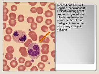 Monosit dan neutrofil
segmen. pada monosit
kromatinkurang padat,
warna dan granularitas
sitoplasma berwarna
merah jambu, ukuran
sering lebih besar dan
terdapatnya banyak
vakuola
 