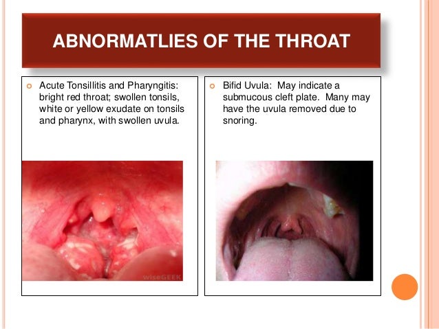 Nose_ Mouth_ and Throat--Physical Assessment--Power Point