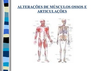 ALTERAÇÕES DE MÚSCULOS OSSOS E ARTICULAÇÕES 