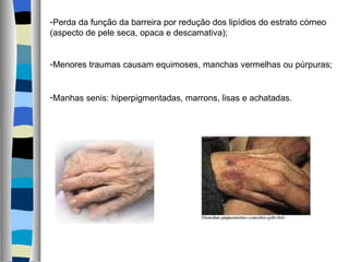 Perda da função da barreira por redução dos lipídios do estrato córneo (aspecto de pele seca, opaca e descamativa); Menores traumas causam equimoses, manchas vermelhas ou púrpuras; Manhas senis: hiperpigmentadas, marrons, lisas e achatadas . 