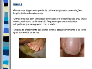 UNHAS Tornam-se frágeis com perda de brilho e surgimento de estriações longitudinais e descolamento; Unhas dos pés com alterações de espessura e opacificação e/ou áreas de escurecimento da lâmina são frequentes por anormalidades ortopédicas que se agravam com a idade; O grau de crescimento das unhas diminui progressivamente e se torna igual em ambos os sexos. 