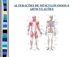 ALTERAÇÕES DE MÚSCULOS OSSOS E
ARTICULAÇÕES
 