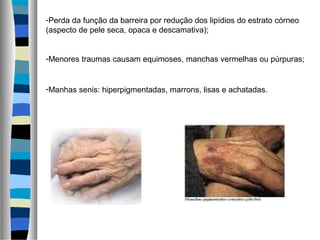 -Perda da função da barreira por redução dos lipídios do estrato córneo
(aspecto de pele seca, opaca e descamativa);
-Menores traumas causam equimoses, manchas vermelhas ou púrpuras;
-Manhas senis: hiperpigmentadas, marrons, lisas e achatadas.
 