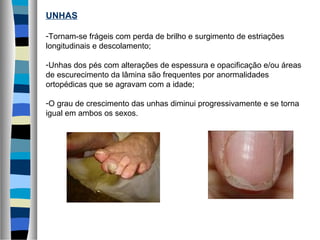UNHAS
-Tornam-se frágeis com perda de brilho e surgimento de estriações
longitudinais e descolamento;
-Unhas dos pés com alterações de espessura e opacificação e/ou áreas
de escurecimento da lâmina são frequentes por anormalidades
ortopédicas que se agravam com a idade;
-O grau de crescimento das unhas diminui progressivamente e se torna
igual em ambos os sexos.
 