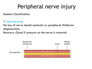 Comprehensive Guide to Extremity Trauma: Investigation and Treatment | PPTX