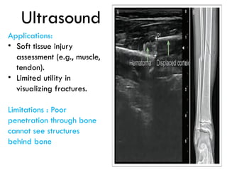 Comprehensive Guide to Extremity Trauma: Investigation and Treatment | PPTX