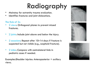 Comprehensive Guide to Extremity Trauma: Investigation and Treatment | PPTX