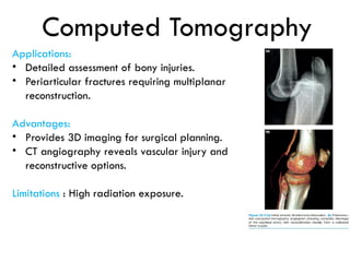Comprehensive Guide to Extremity Trauma: Investigation and Treatment | PPTX