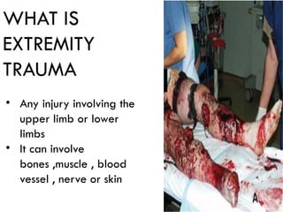 Comprehensive Guide to Extremity Trauma: Investigation and Treatment | PPTX
