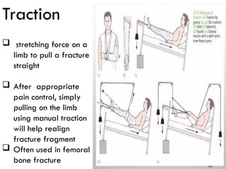 Comprehensive Guide to Extremity Trauma: Investigation and Treatment | PPTX