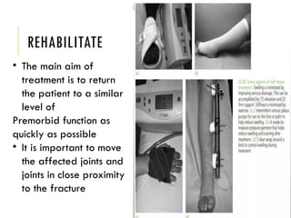 Comprehensive Guide to Extremity Trauma: Investigation and Treatment | PPTX
