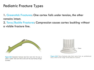 Comprehensive Guide to Extremity Trauma: Investigation and Treatment | PPTX