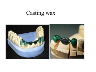 Casting wax
 