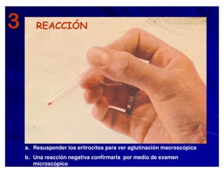 3 REACCIÓN
a. Resuspender los eritrocitos para ver aglutinación macroscópica
b. Una reacción negativa confirmarla por medio de examen
microscópico
 