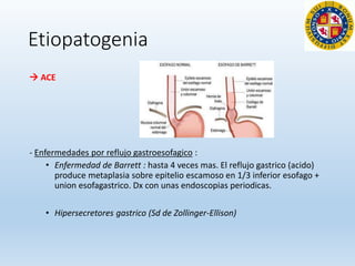 Etiopatogenia
 ACE
- Enfermedades por reflujo gastroesofagico :
• Enfermedad de Barrett : hasta 4 veces mas. El reflujo gastrico (acido)
produce metaplasia sobre epitelio escamoso en 1/3 inferior esofago +
union esofagastrico. Dx con unas endoscopias periodicas.
• Hipersecretores gastrico (Sd de Zollinger-Ellison)
 