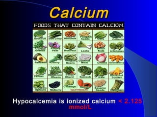 CalciumCalcium
Hypocalcemia is ionized calcium < 2.125
mmol/L
 