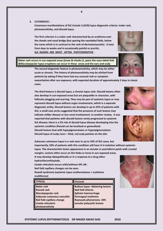 Pcds Photosensitive Rash SLE by DRMAGDI SASI 2016 | PDF